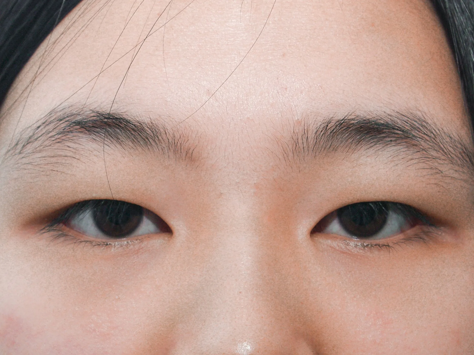 수술 전