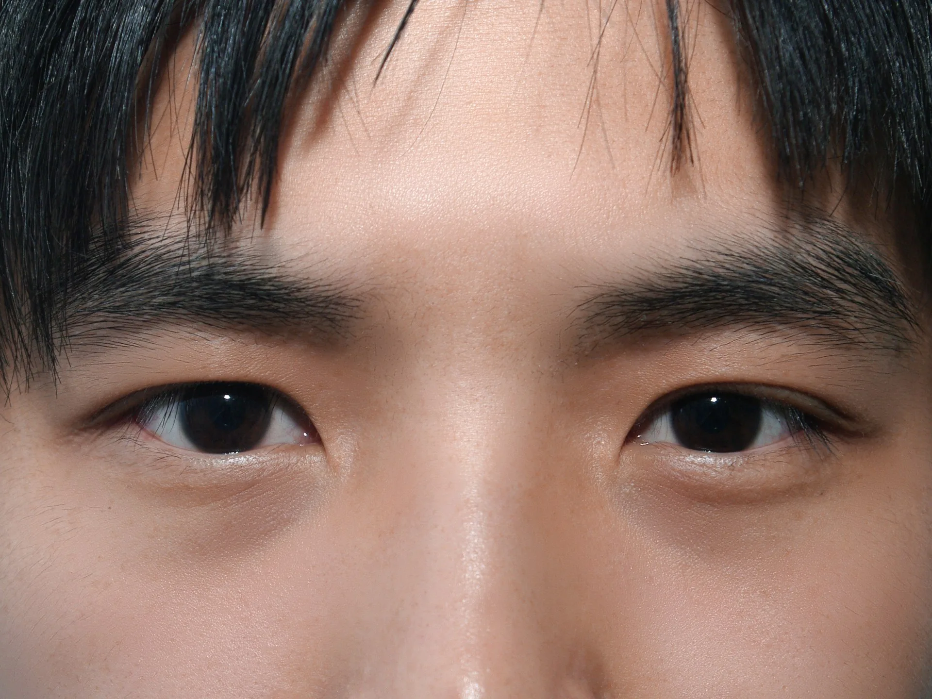 수술 후