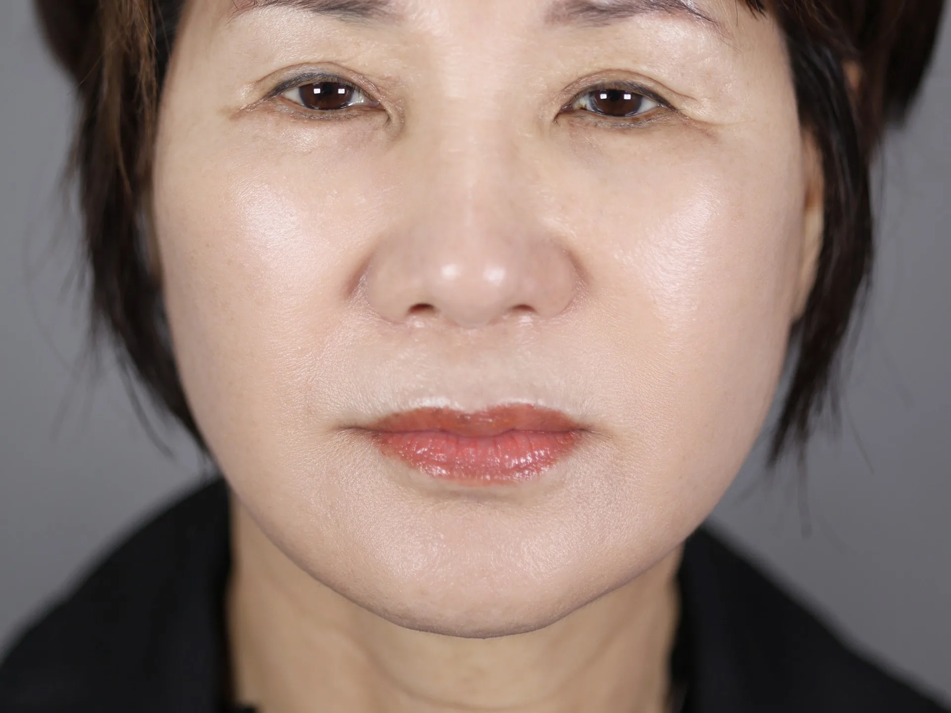 수술 후